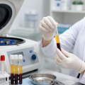 PRP: avanço científico e atualização médica